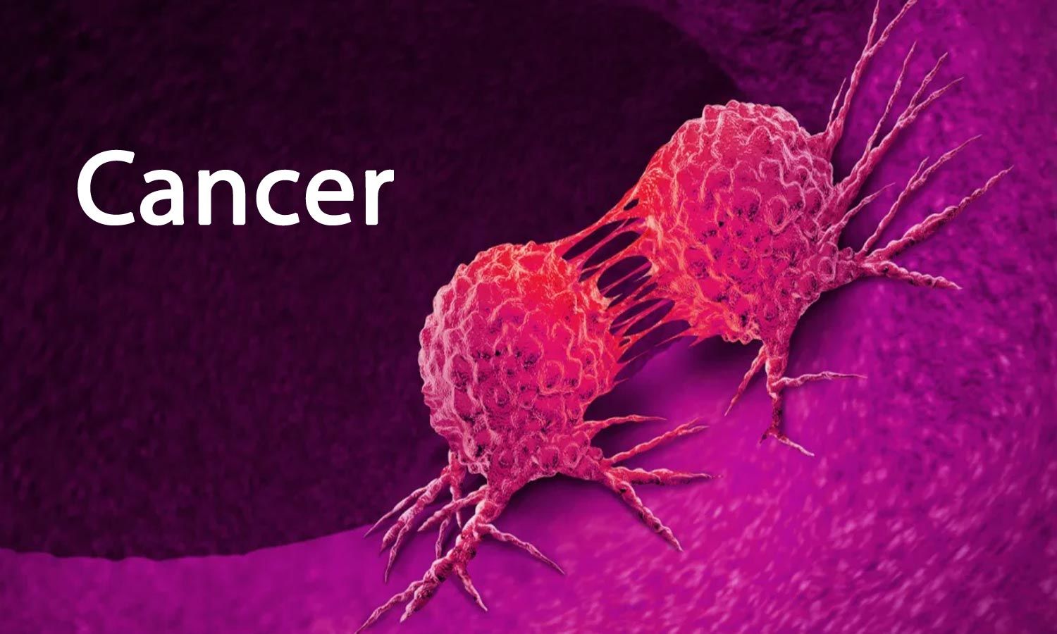 5 Food That Destroys Cancer when Eaten, Start Eating Them Immediately